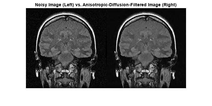 图中包含一个axes对象。标题为“噪声图像”(左)和“各向异性扩散过滤图像”(右)的轴对象包含一个类型为“图像”的对象。