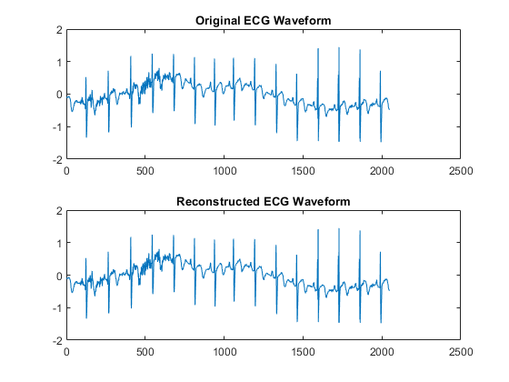 图包含2个轴。具有标题原始ECG波形的轴1包含类型线的对象。具有标题重建的ECG波形的轴2包含类型线的对象。